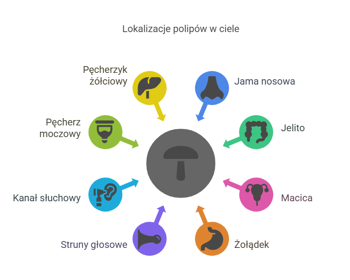 lokalizacja polipów w ciele 