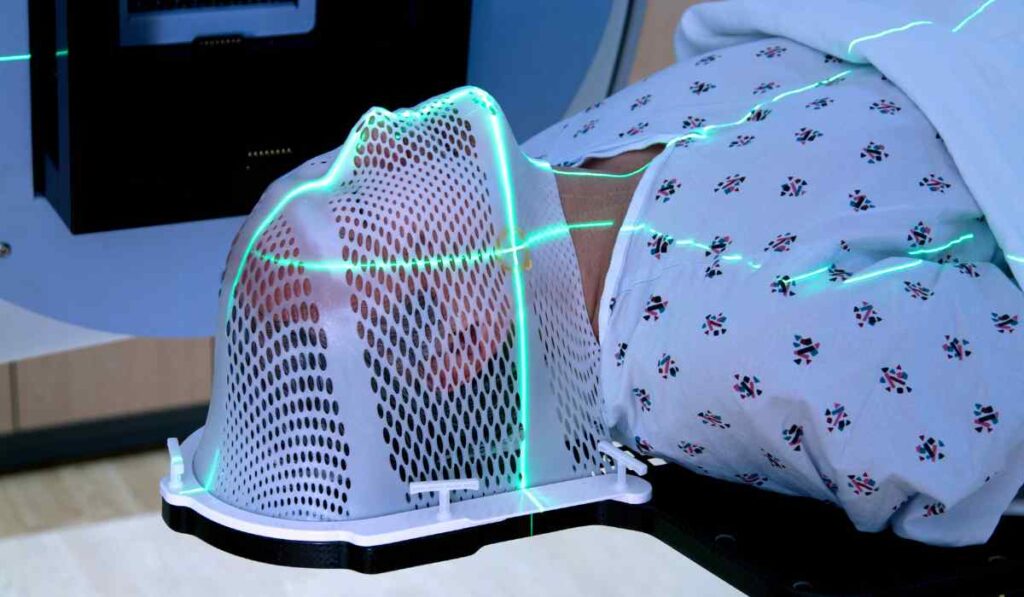 Radioterapia 